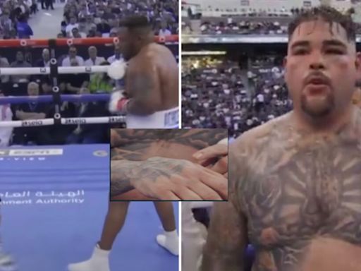 Backstage footage shows the gruesome hand injury Andy Ruiz suffered vs Jarrell Miller