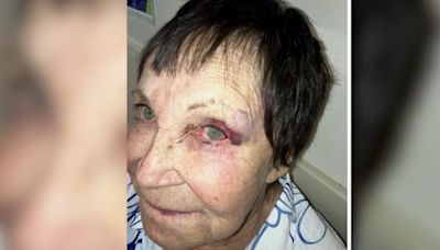 89-year-old stand-up comedian sucker-punched in West Village: "I thought I'd lost my eye"