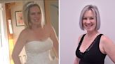 I had my breasts reduced from 30GG to 30DD – and it’s changed my life