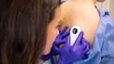 Melanoma Skin Cancer Is At An All Time High In The UK, These Are The Signs To Look For