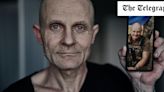 The haunting pictures of emaciated Ukrainian prisoners of war