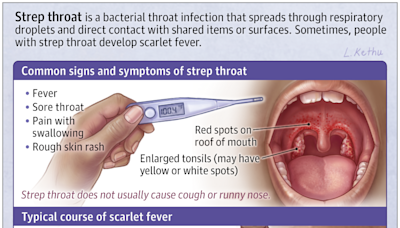 Patient Information: Strep Throat