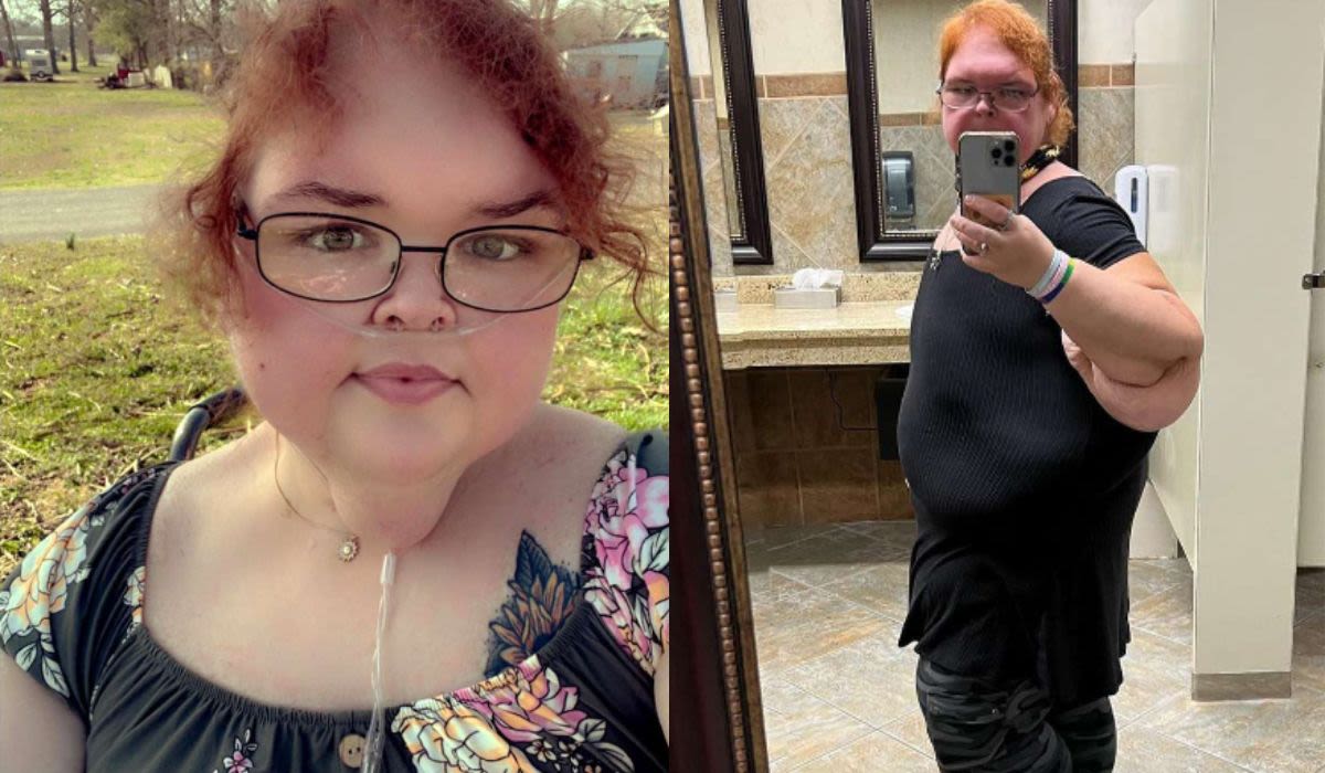1000 Lb Sisters: Tammy’s Skin Removal Delayed? But Why?