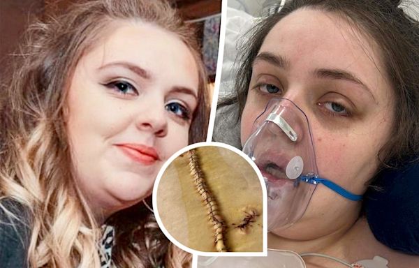 Young mum left fighting for her life in coma after botched surgery in Turkey