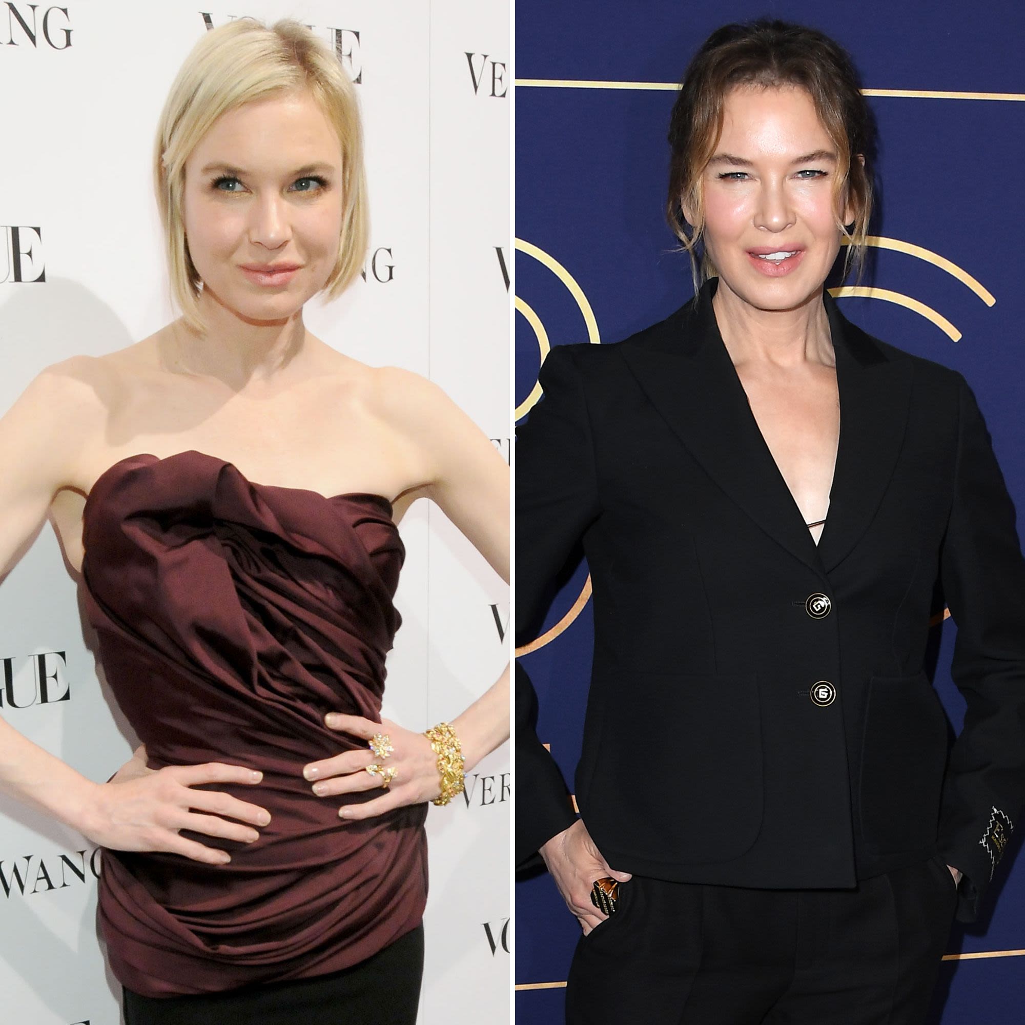 Renee Zellweger’s Shocking Face Transformation: Her Eyes Look ‘Catlike,’ Says Source