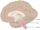 Brainstem