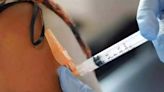Woman, who fell unconscious after being given 'wrong' injection dies; family alleges negligence - ET HealthWorld