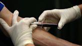 Health Care — FDA to ease blood donation rules for gay, bisexual men