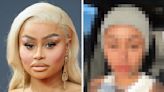 Blac Chyna Posted Her Unedited Face, One Year After Dissolving Her Facial Fillers