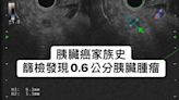 35歲「不菸不酒」長胰臟腫瘤！醫籲「有這些家族史」快篩檢