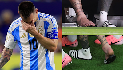 VIDEO: Lionel Messi's ankle swells to the size of a golf ball as Argentina & Inter Miami superstar is brought to tears by injury in Copa America final against Colombia | Goal.com Singapore