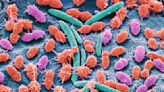 Gut bacteria 'connected to autism'