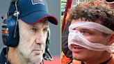 Lando Norris pictured with bandaged face as Adrian Newey salary figure noted – F1 news round-up