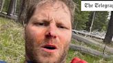 Veteran survives bear attack after animal accidentally bit spray can