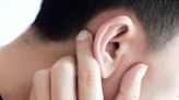 What scabs, earwax and tears are trying to tell you | CNN