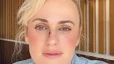 Rebel Wilson Shows Off War Wounds, Updates On-Set Injury While Filming ‘Bride Hard’