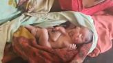 VIDEO: Woman Gives Birth To Baby With 2 Faces, 4 Legs & 4 Arms In UP's Sitapur; Newborn Dies Within Few Hours