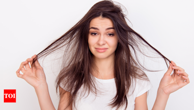 Is vitamin D deficiency the reason behind your hair loss? - Times of India