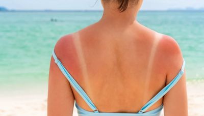 Cómo proteger la piel del daño del sol y el cáncer