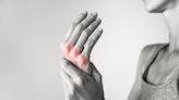 Oxford BioDynamics and Kings College London to advance rheumatoid arthritis treatment