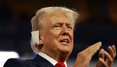 Actor Mark Hamill Under Fire For Mocking Trumps "Oversized Ear Bandage"