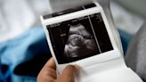 Red states that banned abortion consider expanding Medicaid for mothers