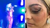 Bebe Rexha recibe sutura en el rostro tras agresión de un fan