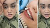 ‘Those teeth are not salvageable’: Dental worker issues warning after catching ‘veneer tech’ doing something ‘terrifying’