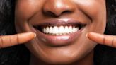 TikToker erzählen Horrorgeschichten von Zahnbehandlungen durch nicht-lizenzierte "Veneer-Techniker"