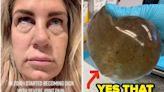 "Yes, That's Mold" — For Years, This Woman Suffered Unimaginable Symptoms, Not Knowing Her Breast Implants Were The Cause. Here...