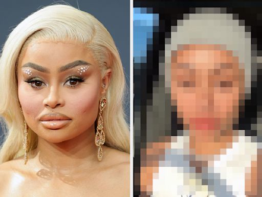 Blac Chyna Posted Her Unedited Face, One Year After Dissolving Her Facial Fillers