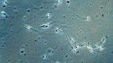 Everything You Need To Know About Sperm Motility When Trying To Conceive