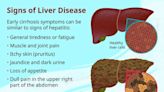 What Are Signs of Liver Disease?