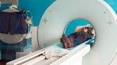 Study highlights concern over ‘missed’ pancreatic cancer in scans