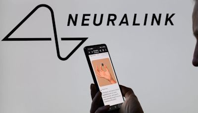 Elon Musk gives an update on Neuralink's brain-chip business. These are 5 things you can expect in the near future.