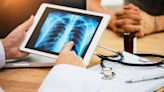 US tuberculosis cases were at the highest level in a decade in 2023