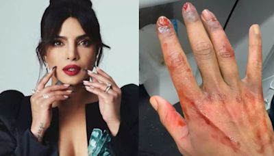 Priyanka Chopra Shocks Fans With Clip Of Injured Hand From The Bluff Sets, But There Is A Twist