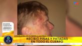 Impactante: otro brutal ataque de rugbiers en un boliche de Zárate revive el horror del crimen de Fernando Báez Sosa