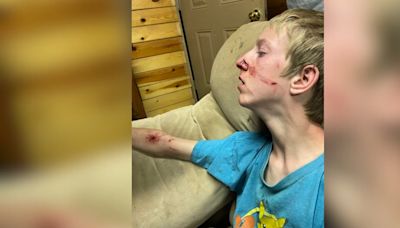 GRAPHIC: 15-year-old boy attacked by bear that got in family’s cabin