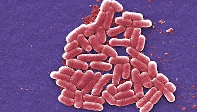 At least 86 people infected with E. coli rushed to hospital in outbreak