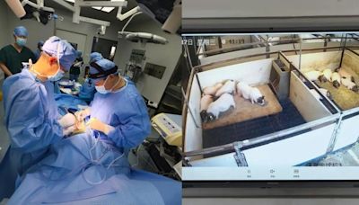 全球首宗！安徽醫院成功移植豬肝給肝癌患者 術後7天一切正常
