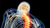 Revolutionizing Spinal Injury Treatment: Common Drug Found To Prevent Damage to Fat Tissue