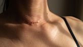 Signs and Symptoms That Thyroid Cancer Is Metastasizing