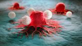 Improving treatment by helping immune system see cancer