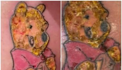 Se hizo un tatuaje de Winnie The Pooh, el resultado no fue el esperado y ahora vive un calvario