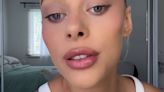 Influencer reveals her genius beauty hack while banned from lip filler