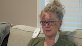 63-year-old woman survives 300-foot fall while hiking