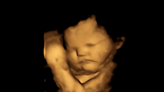 寶寶在子宮裡就懂得挑食！最新研究：羽衣甘藍的味道讓胎兒做出鬼臉