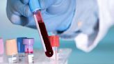 Nuevo análisis de sangre revolucionará tratamientos contra el cáncer