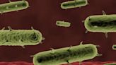 Colorado health officials confirm case of human plague